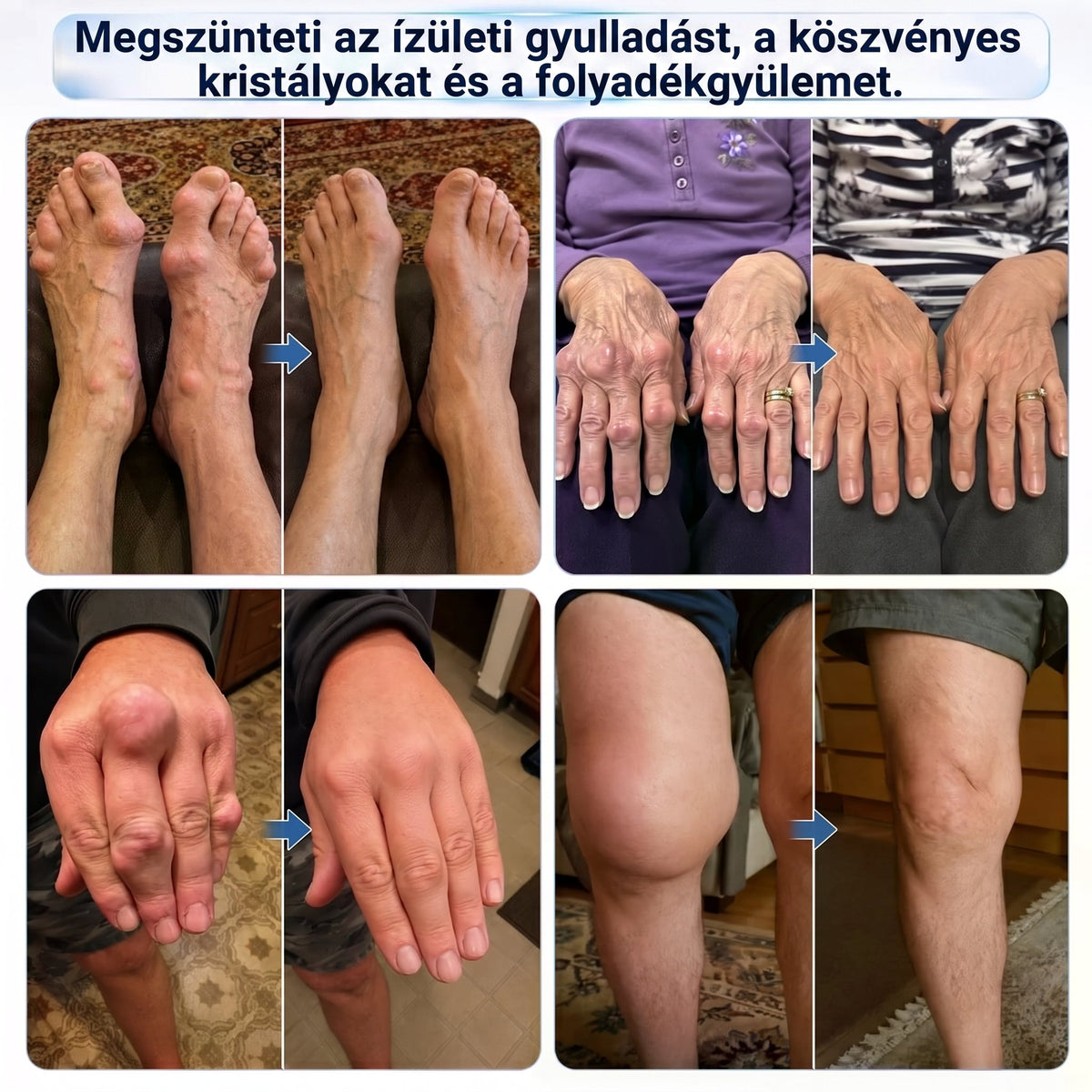 DR.HONOR® KOMPLEX ÍZÜLETI ÁPOLÁS Mélyreható regeneráló roll-on ízületekre és izmokra 🦴