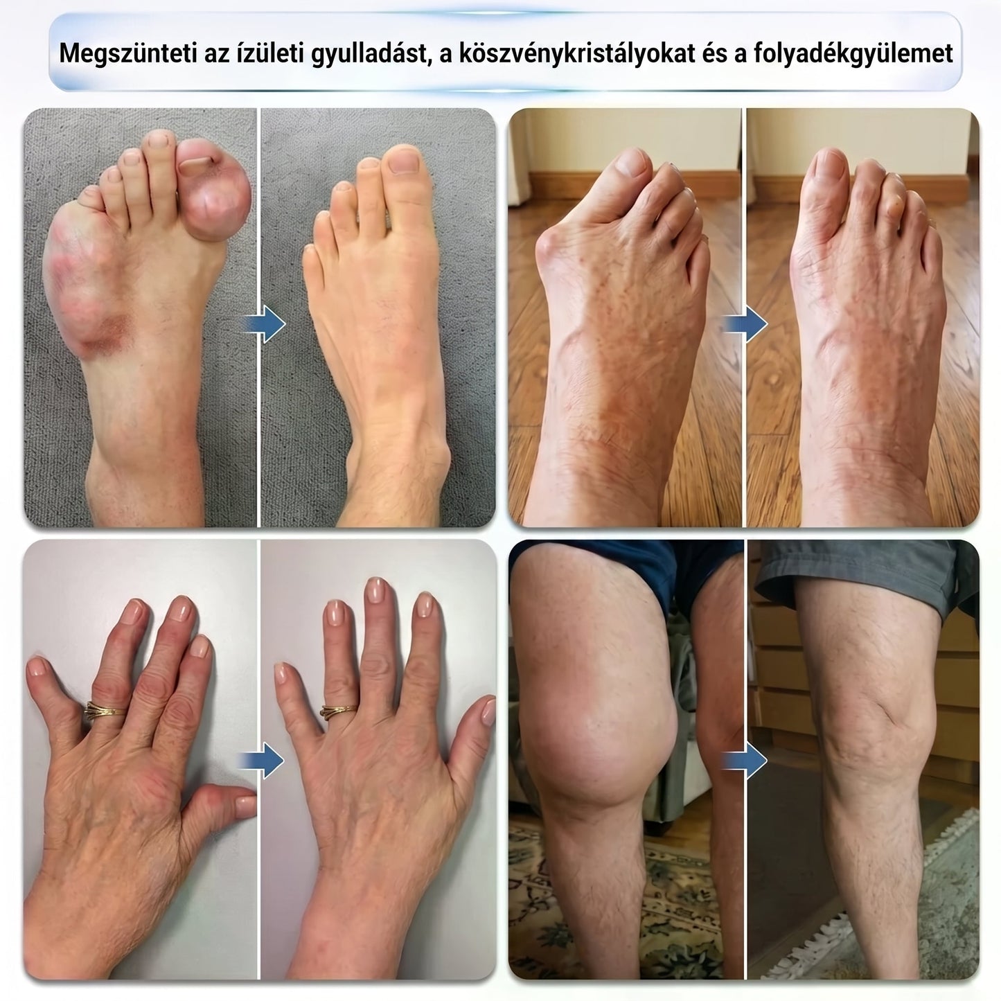 DR.HONOR® KOMPLEX ÍZÜLETI ÁPOLÁS Mélyreható regeneráló roll-on ízületekre és izmokra 🦴